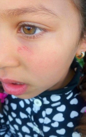 طفلة في السادسة من عمرها تدرس بمدرسة التقدم الابتدائية بعين عائشة بتاونات تتعرض إلى الاعتداء على يد معلمها