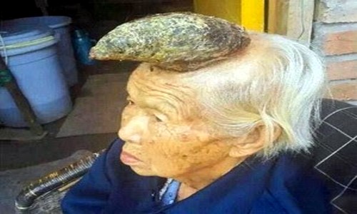 غريب …عجوز صينية تملك قرنا كبيرا فوق رأسها