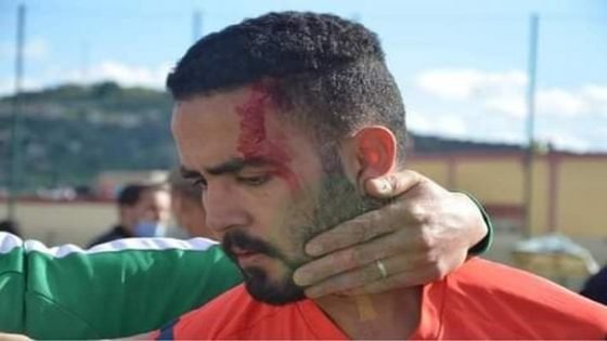 العصبة الجهوية بفاس تصدر قرار التوقيف مدى الحياة في حق لاعب إعتدى على الحكم رضا بوعدلية بملعب تاونات