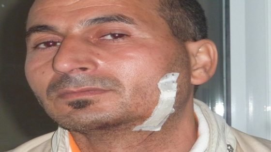 الدمغي بين مطرقة التهجير وسندان القتل…إجبار مواطن ببني احمد بالحسيمة على اللجوء بمنطقة مرنيسة بتاونات