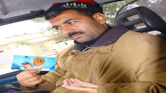 مواطن من قرية أبا محمد يطلب مساعدة لإجراء عملية جراحية لإعادة يده اليسرى المبتورة