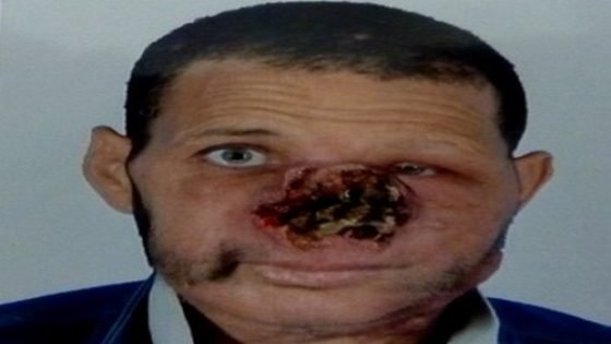 نداء إنساني:سائق يقيم بساحل بوطاهر بجماعة مزراوة باقليم تاونات مصاب بمرض خبيث بحاجة لمساعدة