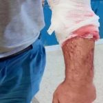 إمام ينحدر من تاونات يتعرض لمحاولة قتل يوم عيد الفطر بإحدى المساجد بمدينة الحسيمة‎